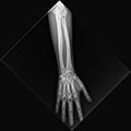 X-Ray Phantom Lower Arm, transparent 2